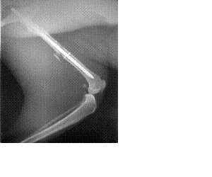 osteosintez.gif