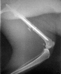 osteosintez.gif