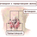 gipoparatireoz20.png