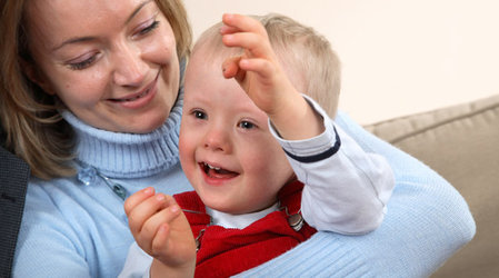 Причины синдрома Дауна 